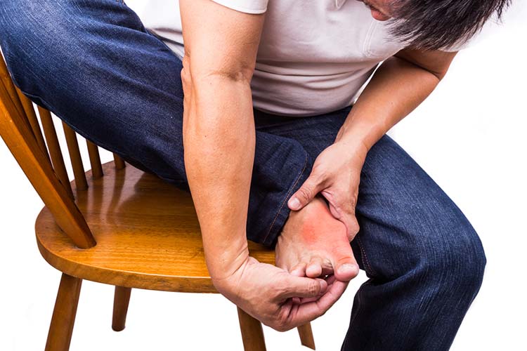 高尿酸血症及び痛風とは